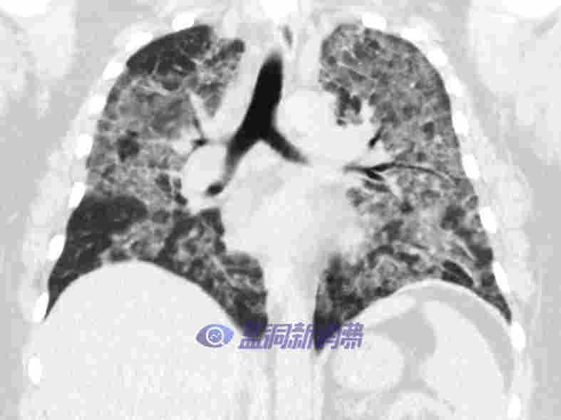 价值4000万美元的健康警告：Juul还面临14个州起诉 